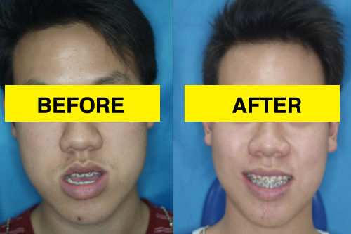 Malaysia Dentist Case Study